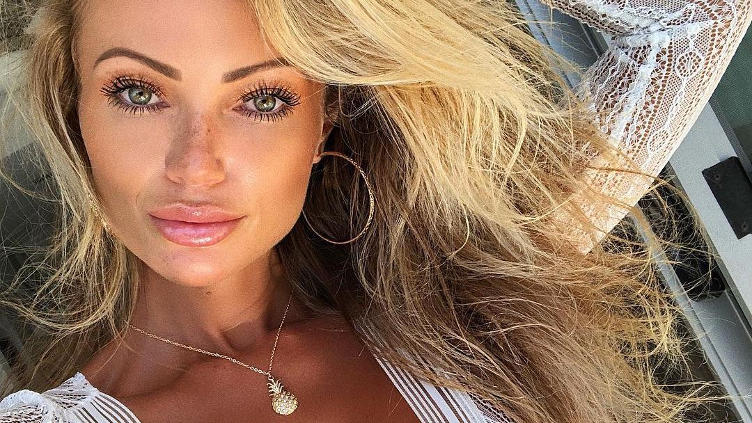 Abby Dowse nose job