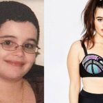 Barbie Ferreira body measurements facelift botox