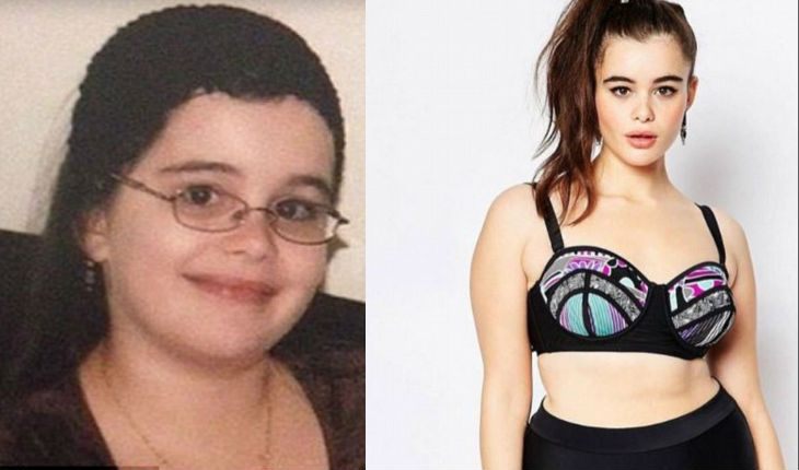 Barbie Ferreira body measurements facelift botox