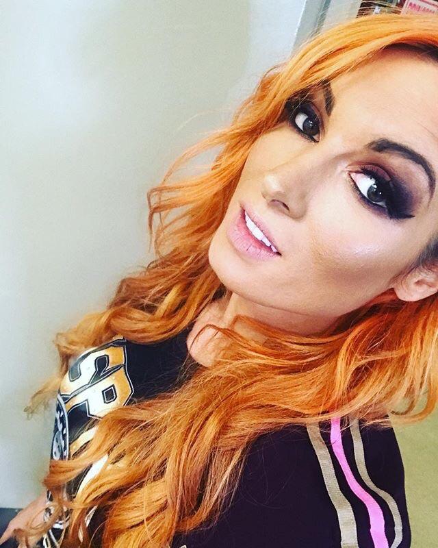 Becky Lynch nose job