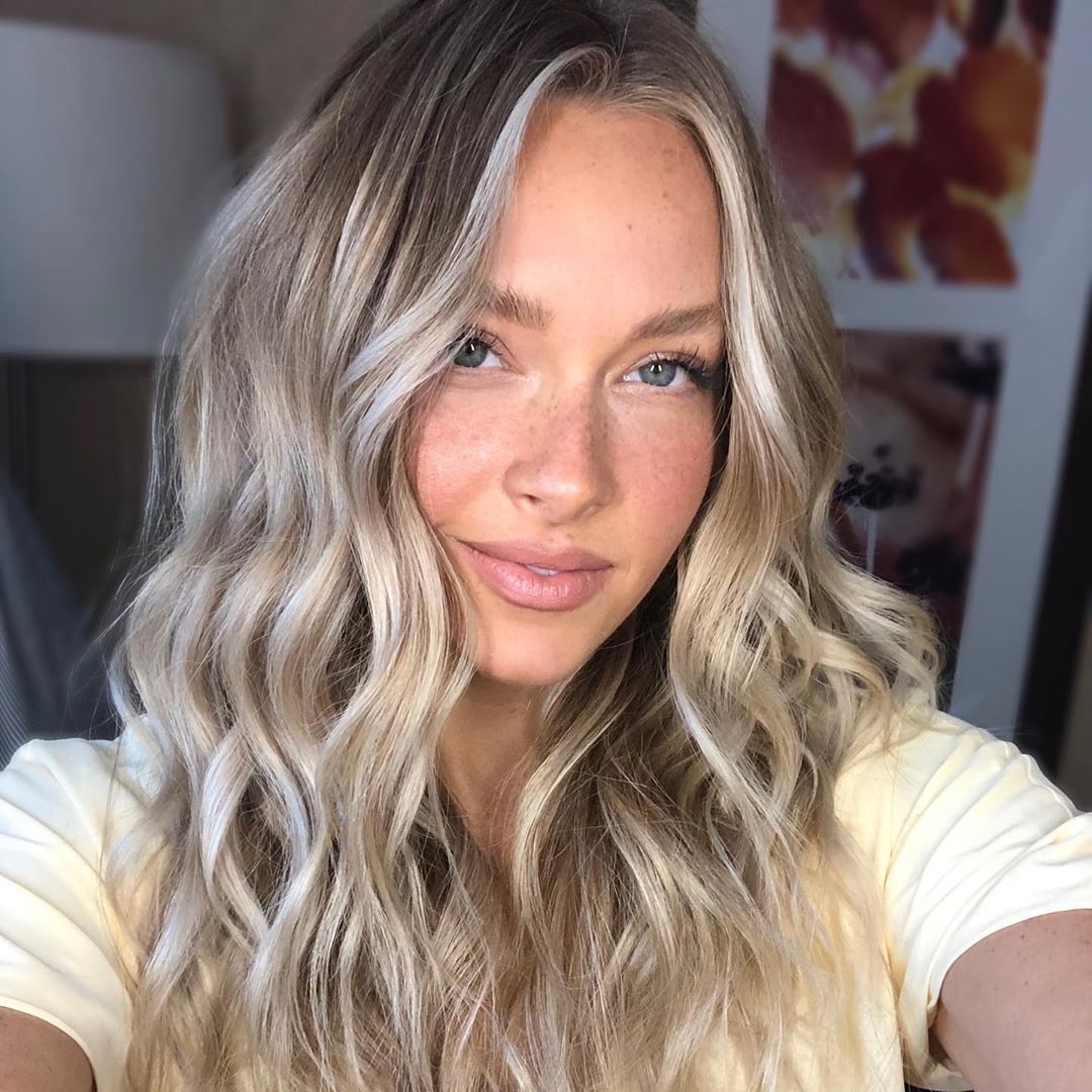 Camille Kostek lip fillers