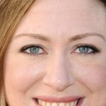 Chelsea Clinton nose job lips facelift