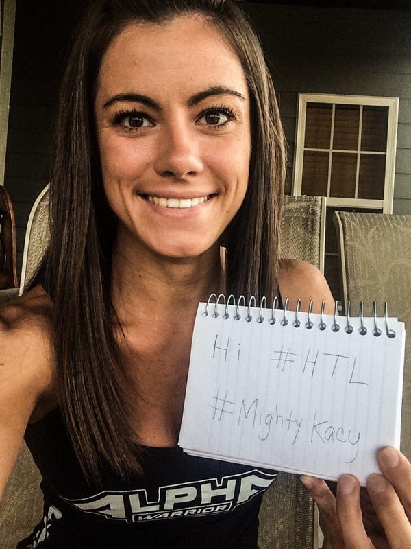 Kacy Catanzaro nose job