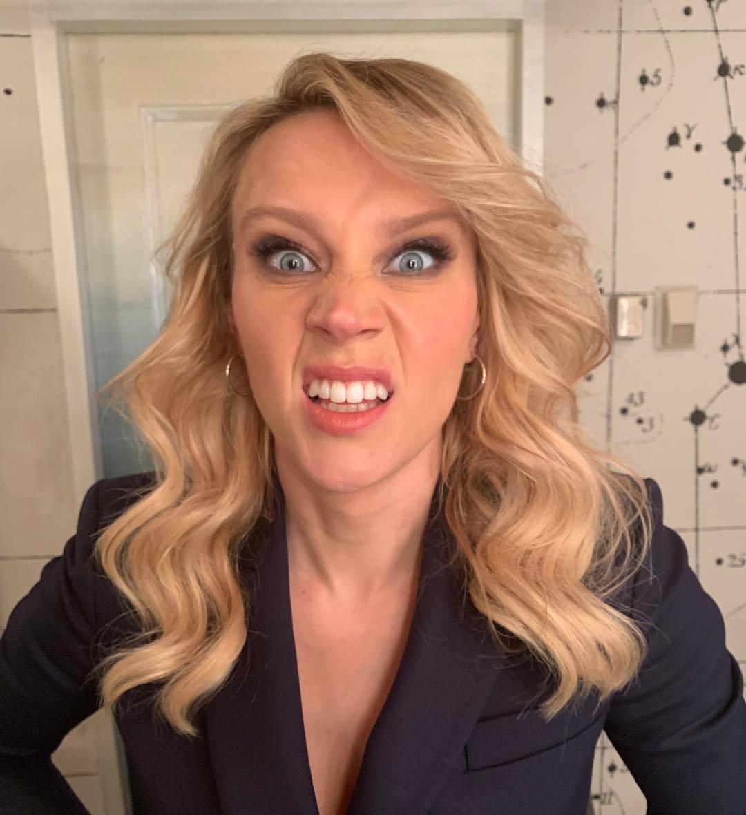 Kate McKinnon lip fillers