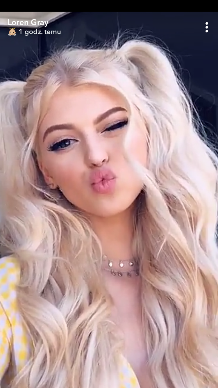 Loren Gray botox