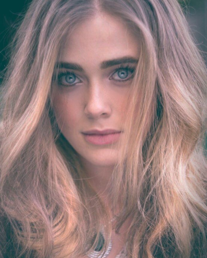 Melissa Roxburgh plastic surgery