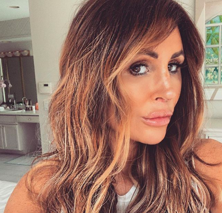 Rachel Uchitel lip fillers