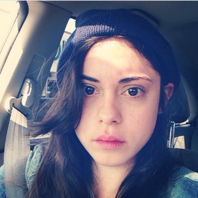 Rosa Salazar lip fillers