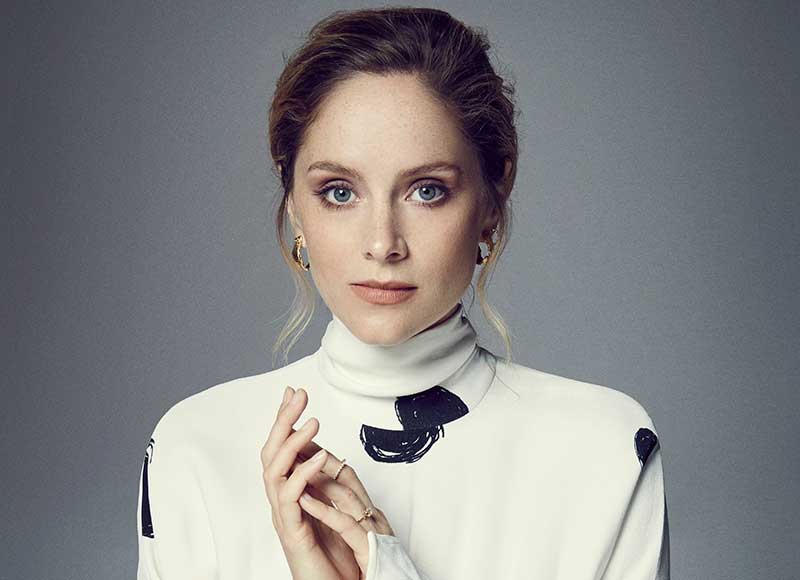 Sophie Rundle botox