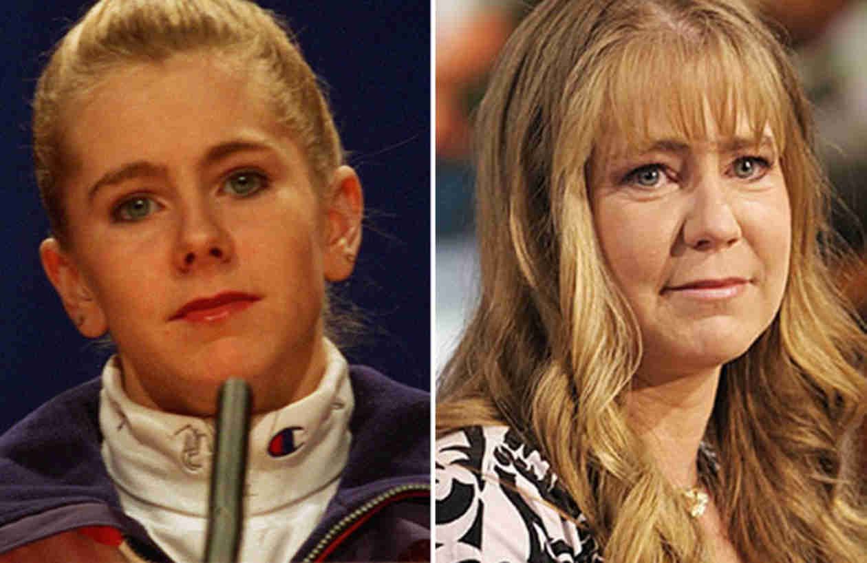 Tonya Harding facelift