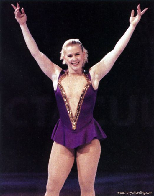 Tonya Harding plastic surgery procedures