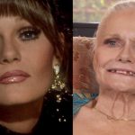 Valerie Perrine boob job botox nose job