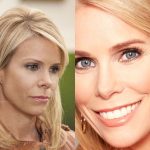 Cheryl Hines Plastic Surgery