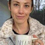 Autumn Calabrese Plastic Surgery