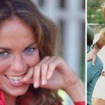 Catherine Bach Plastic Surgery Procedures