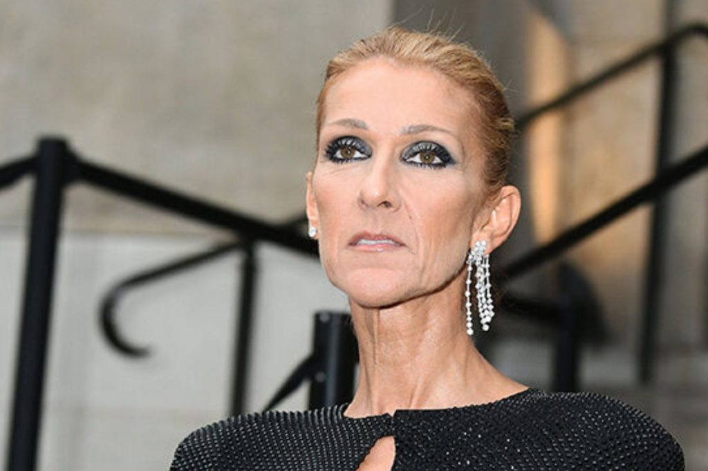 Celine Dion Cosmetic Surgery Face
