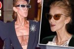 Celine Dion Plastic Surgery and Body Measurements
