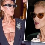 Celine Dion Plastic Surgery and Body Measurements