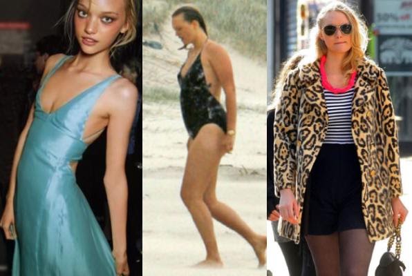 Gemma Ward Cosmetic Surgery Body