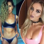 Perrie Edwards Plastic Surgery