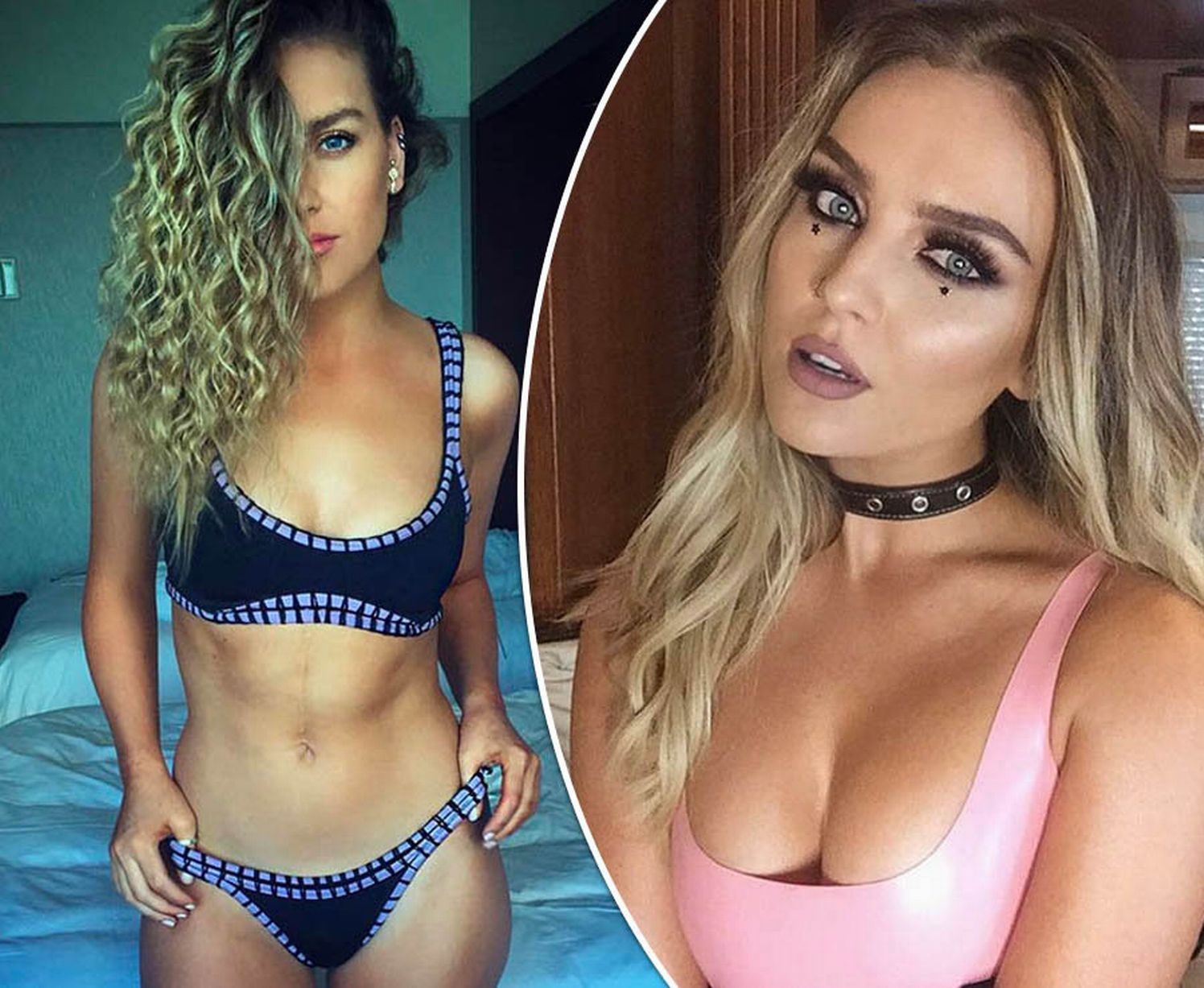 Perrie Edwards Plastic Surgery