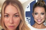 Stassi Schroeder Plastic Surgery and Body Measurements