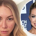 Stassi Schroeder Plastic Surgery and Body Measurements