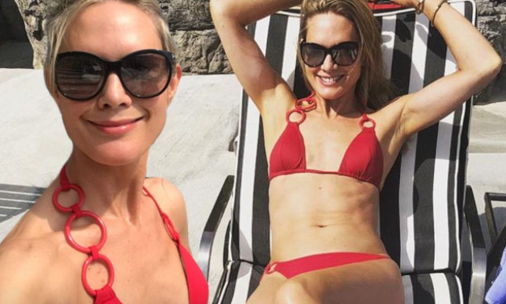 Stephanie March Plastic Surgery