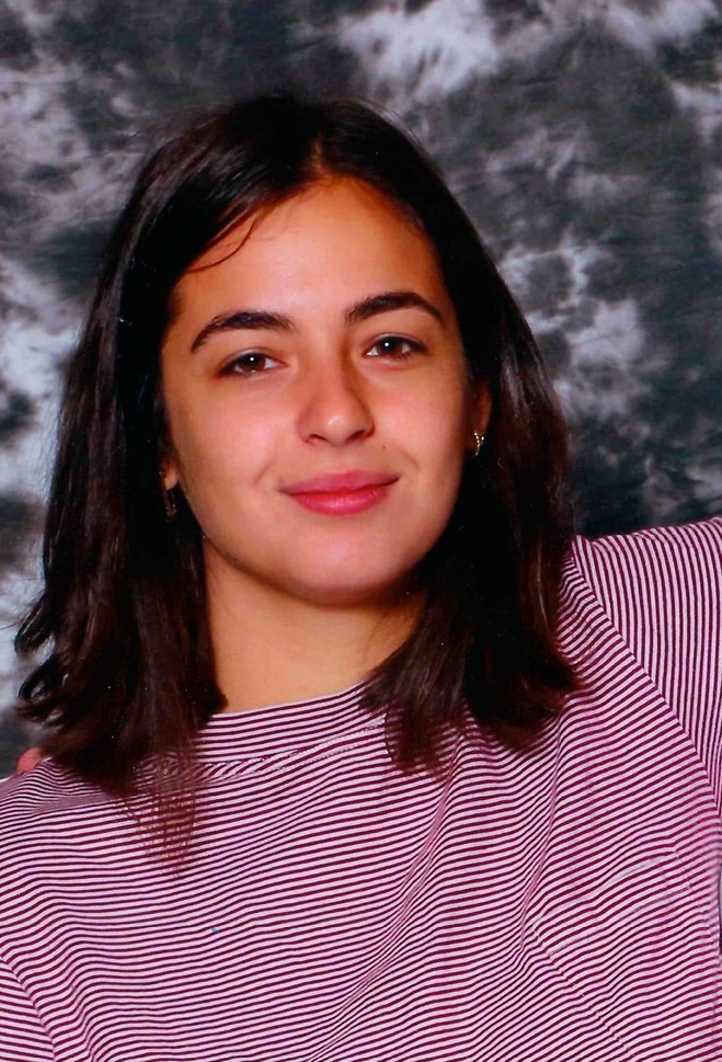 Alanna Masterson Cosmetic Surgery Face