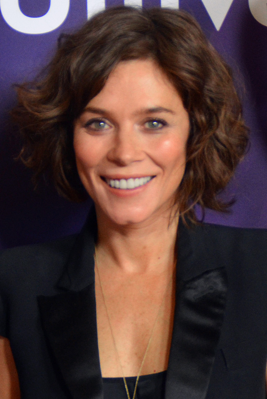 Anna Friel Facelift plastic surgery