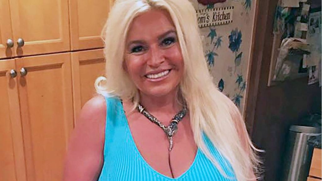 Beth Chapman Plastic Surgery and Body Measurements