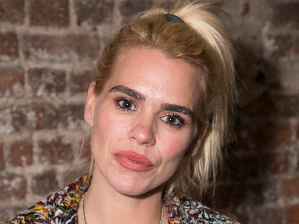 Billie Piper Cosmetic Surgery Face