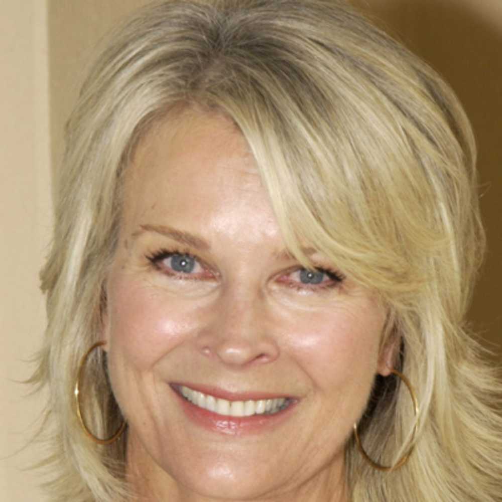 Candice Bergen Plastic Surgery Face