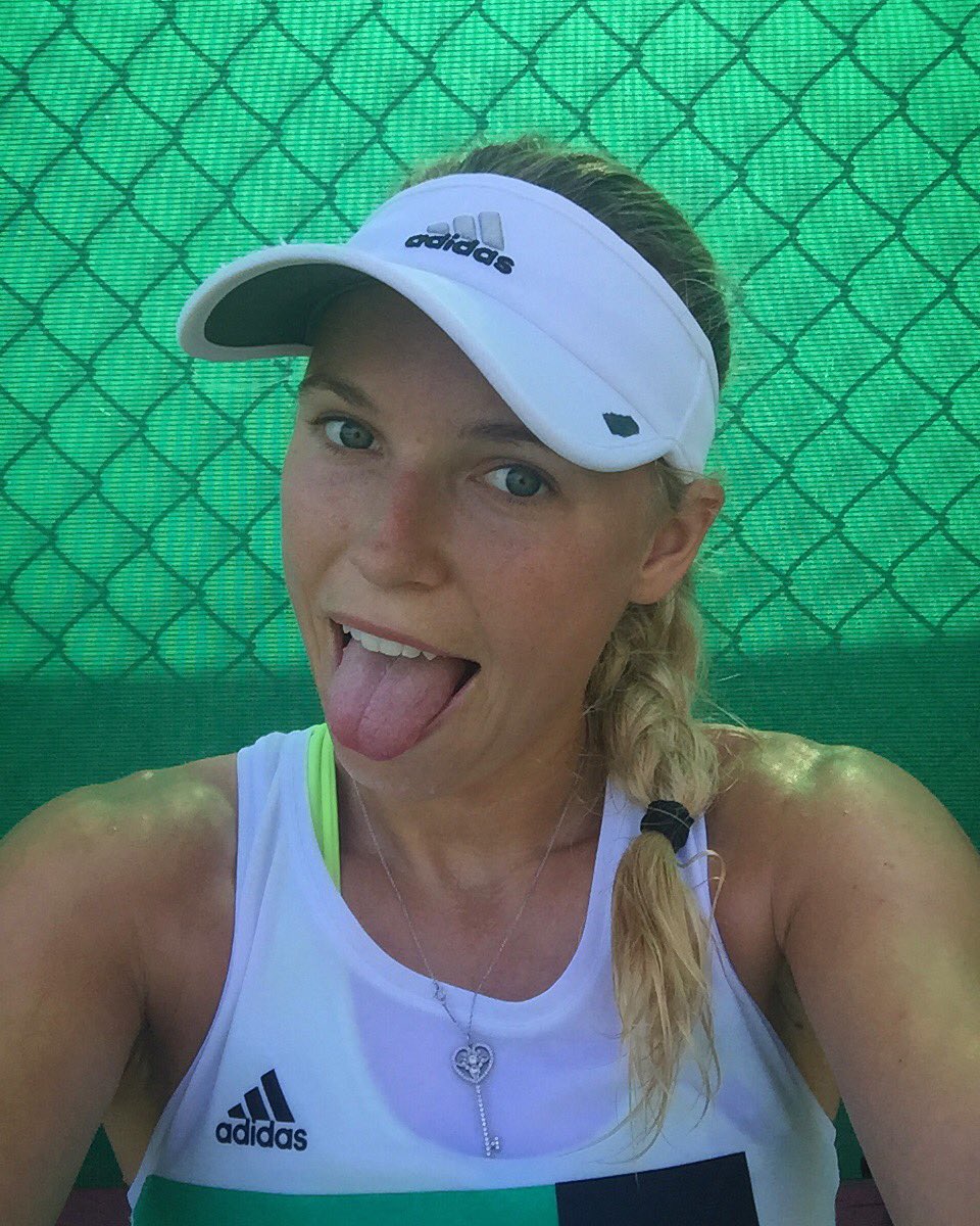 Caroline Wozniacki Plastic Surgery Face