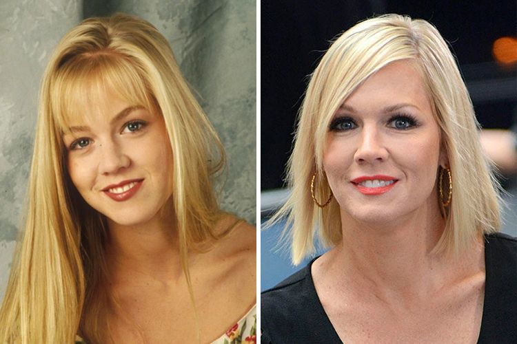 Jennie Garth Plastic Surgery Procedures