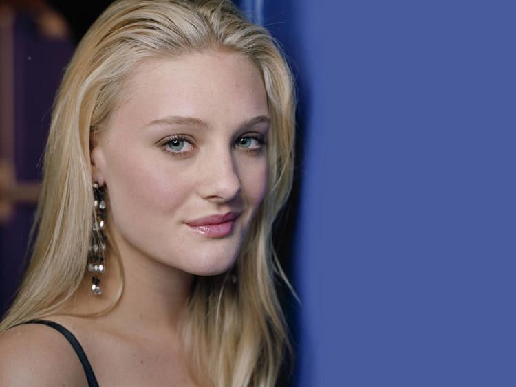 Romola Garai Plastic Surgery Face