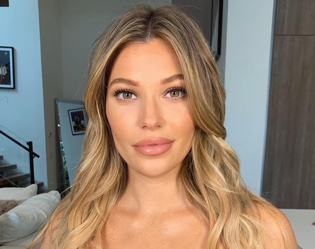 Samantha Hoopes Plastic Surgery Face