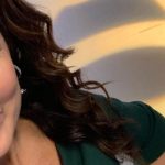 Amy Freeze Plastic Surgery