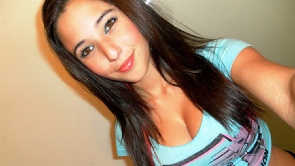 Angie Varona Plastic Surgery