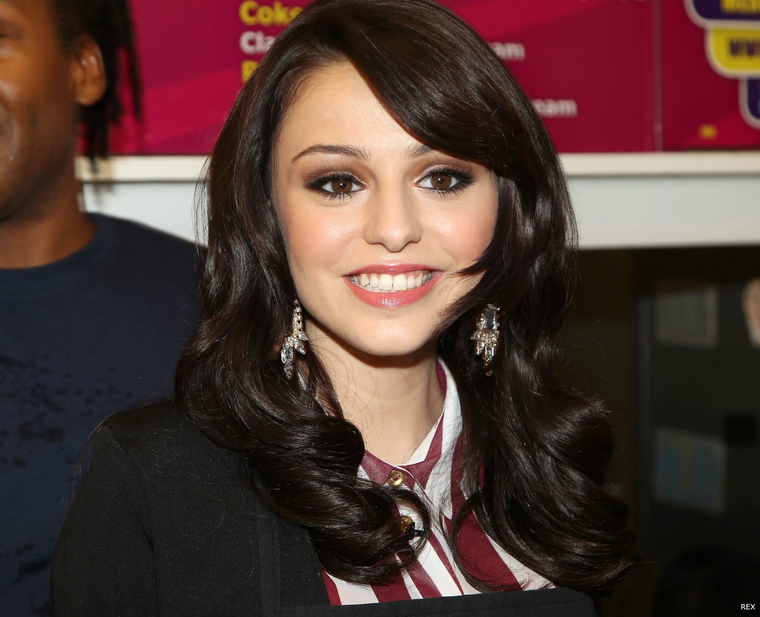 Cher Lloyd Cosmetic Surgery Face