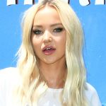 Dove Cameron Cosmetic Surgery Lips