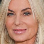 Eileen Davidson Cosmetic Surgery
