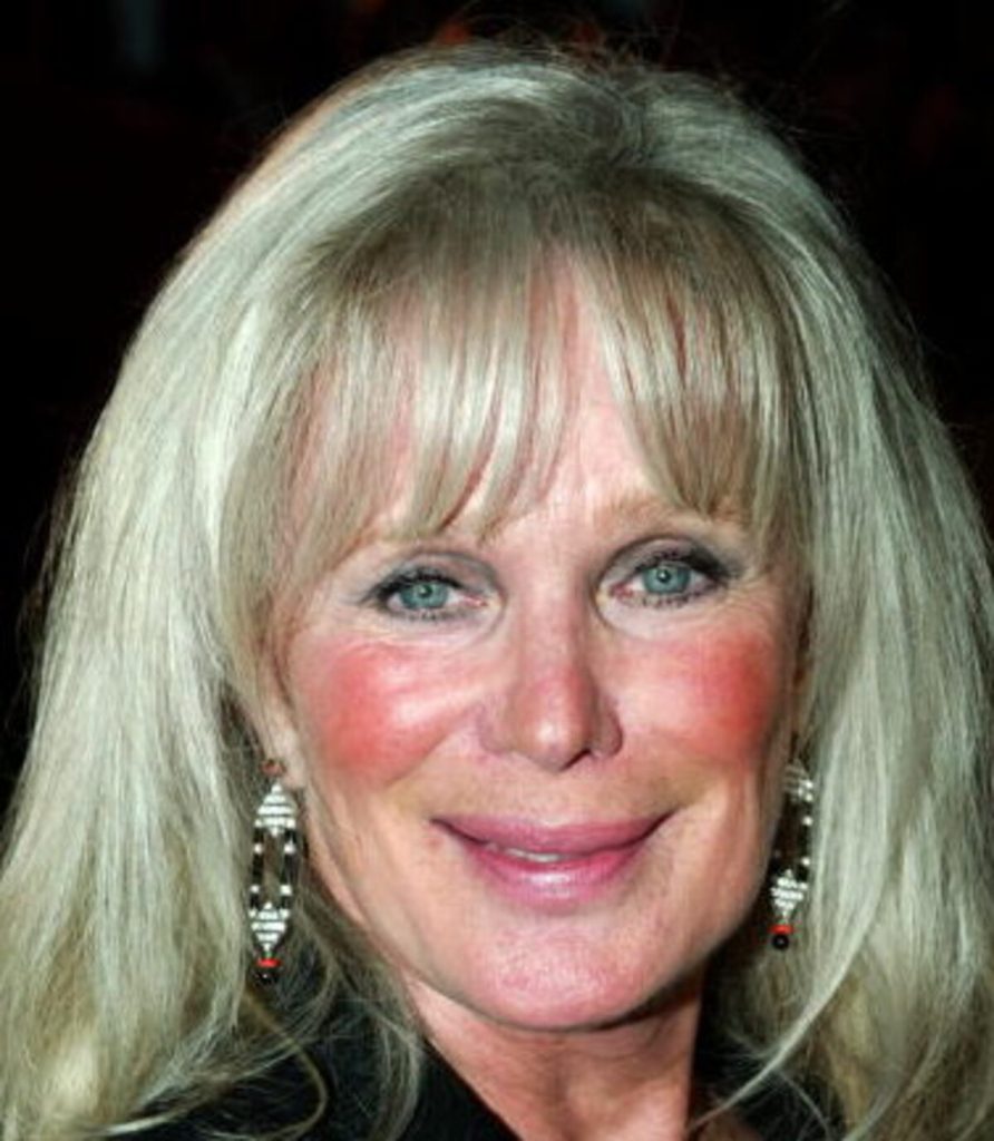 Linda Evans Plastic Surgery Face