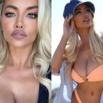 Lindsey Pelas Plastic Surgery and Body Measurements