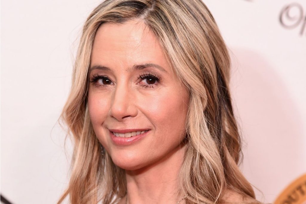Mira Sorvino Plastic Surgery Procedures