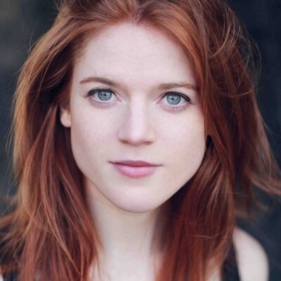 Rose Leslie Plastic Surgery Face