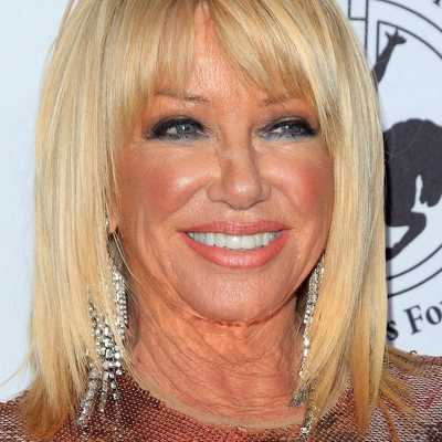 Suzanne Somers Cosmetic Surgery Face