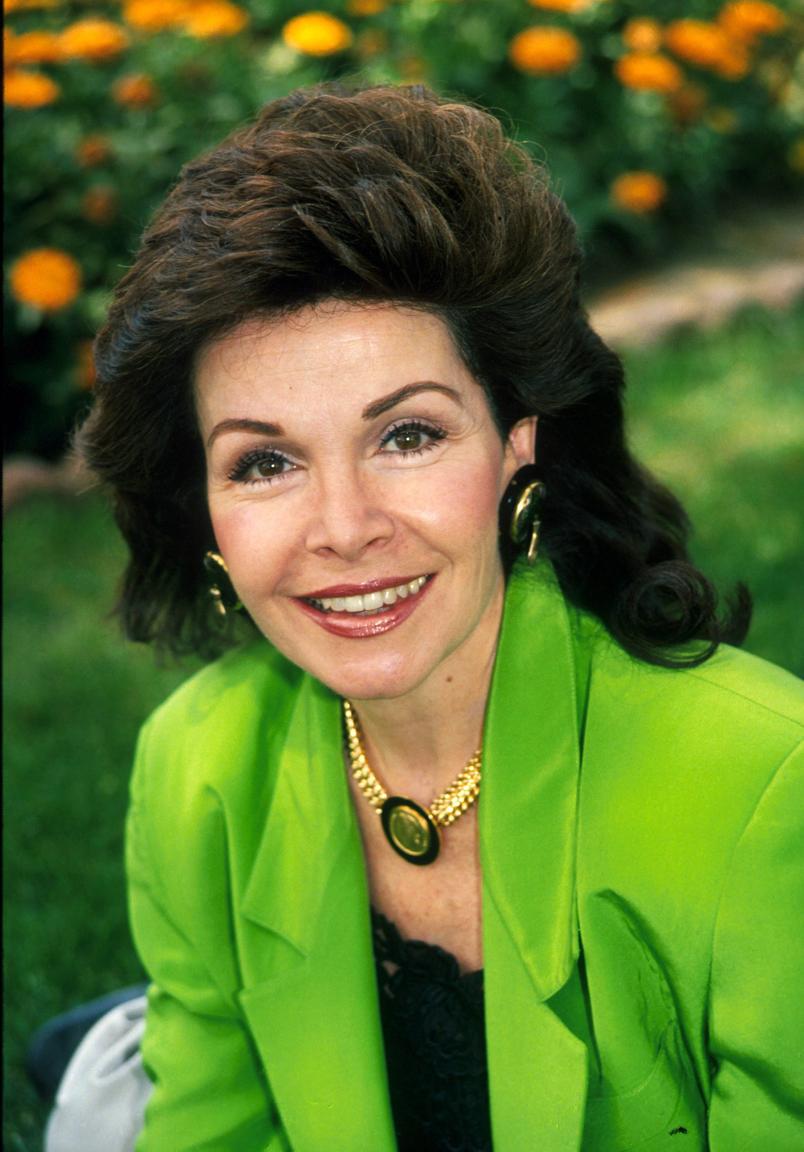 Annette Funicello Cosmetic Surgery Face