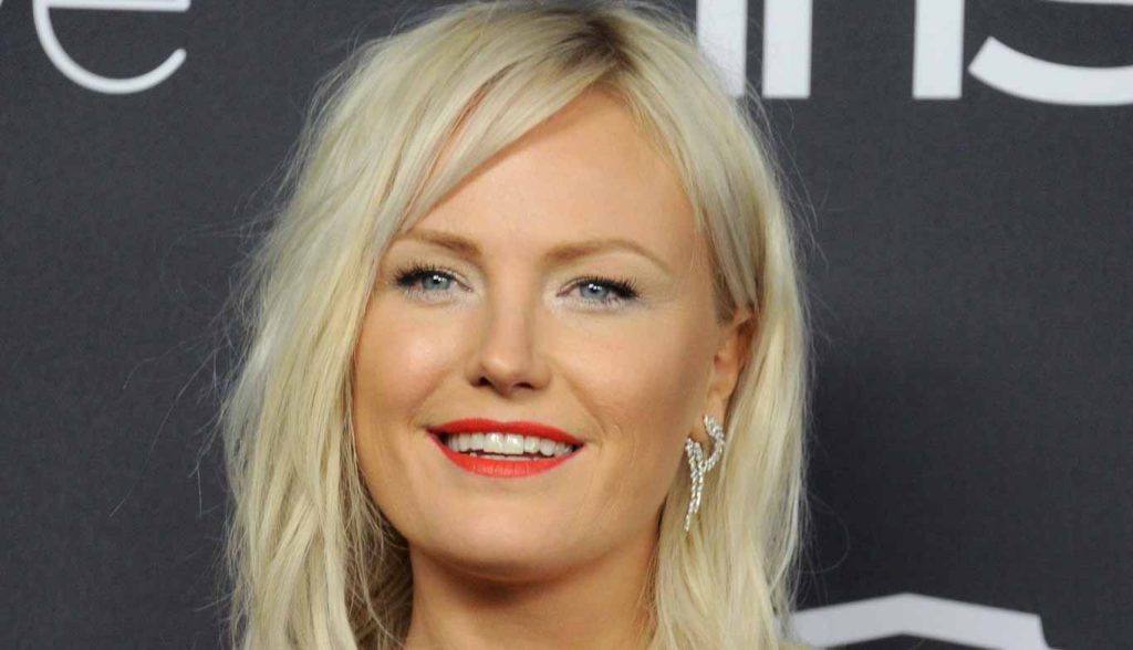 Malin Akerman Plastic Surgery