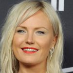 Malin Akerman Plastic Surgery